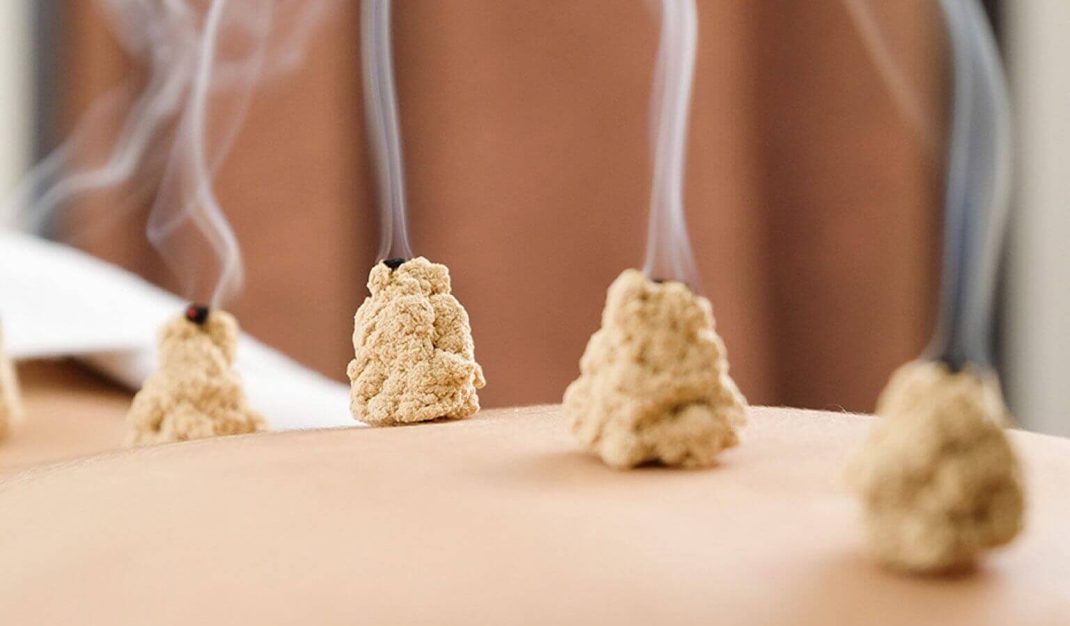 Moxibustion TCM am Chiemsee